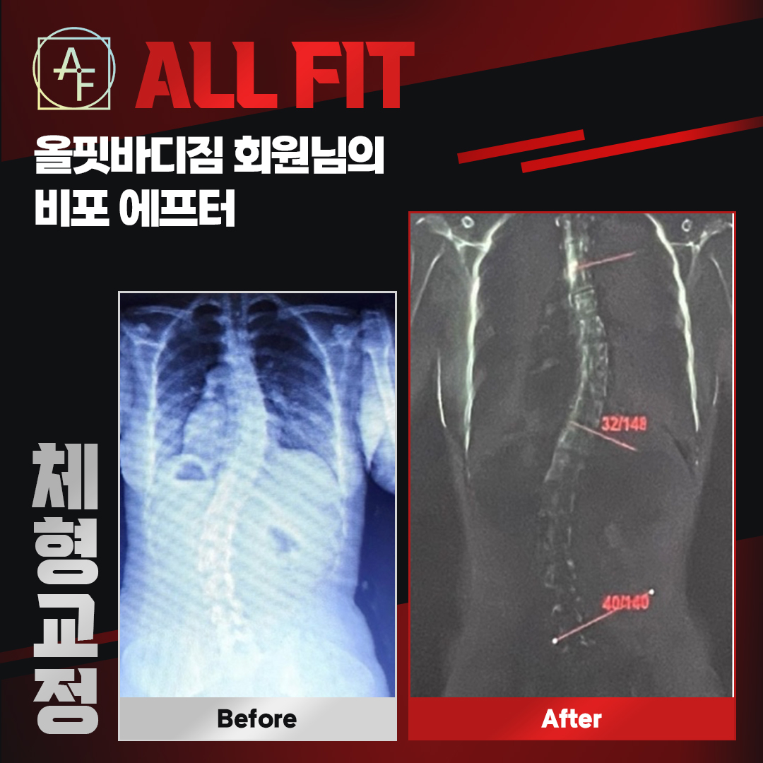 올핏바디 스포츠사이언스랩 PT&재활센터 대표 이미지