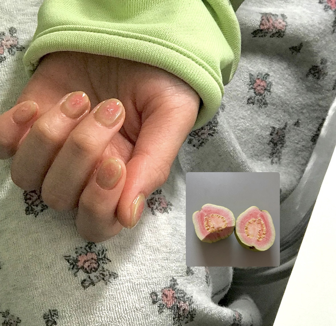 르비쥬네일 강남본점 대표 이미지