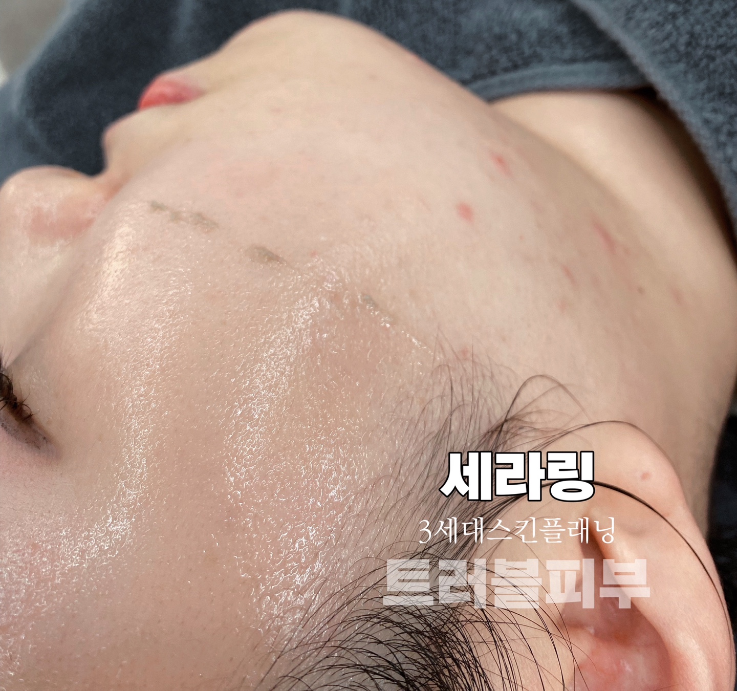 루블링뷰티왁싱피부 건대점 대표 이미지