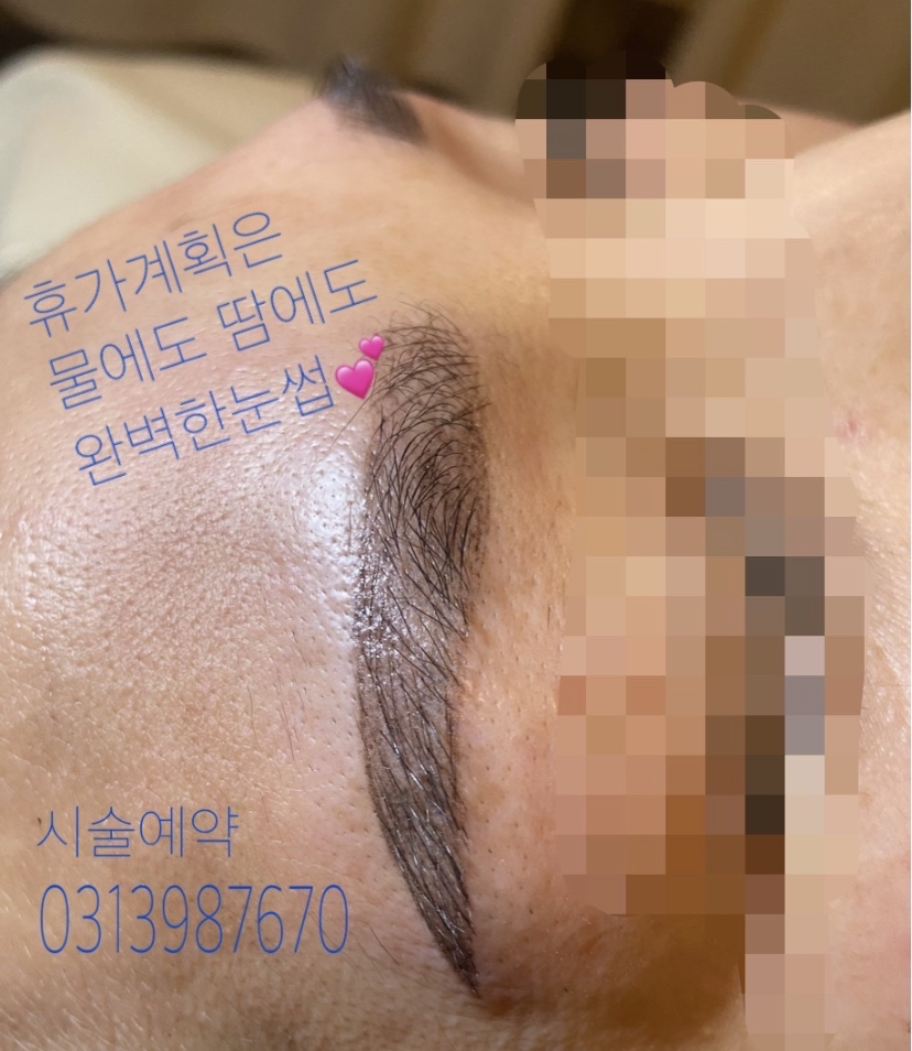 정피부 photo 8