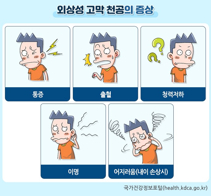 이야시아로마 photo 7