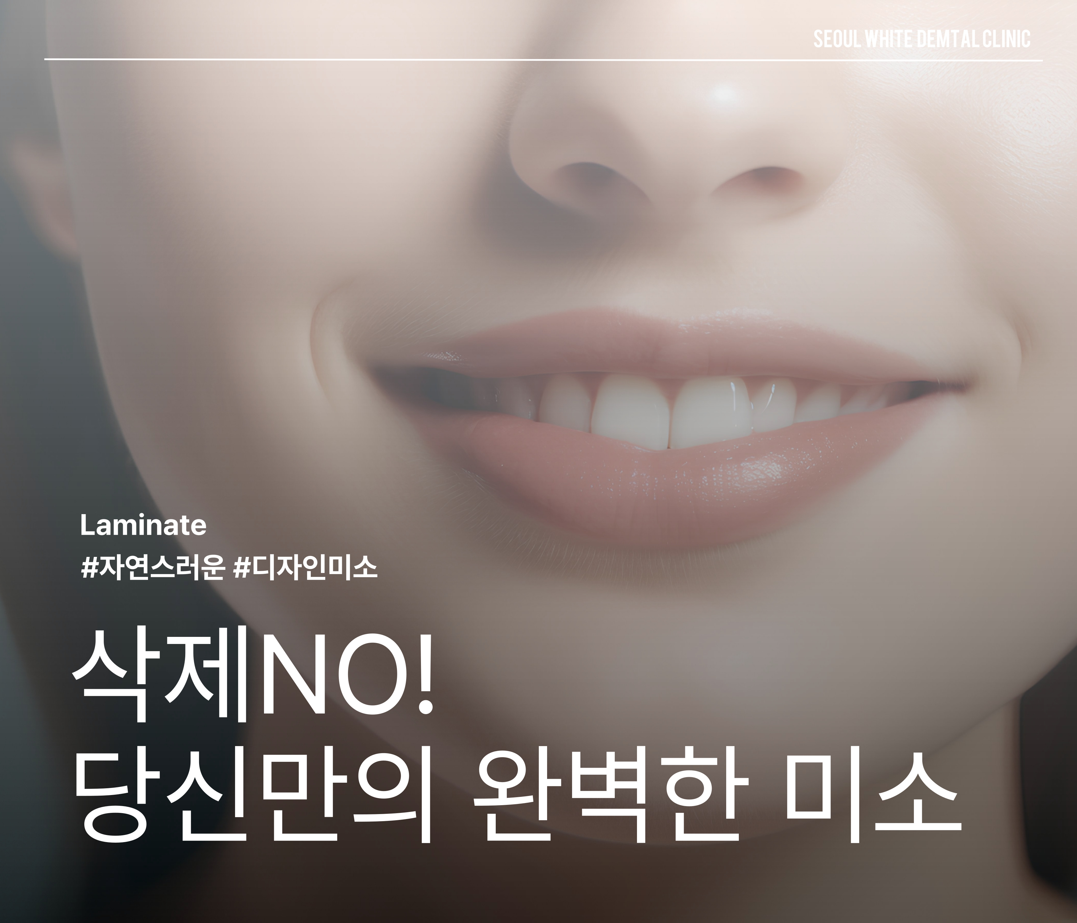 서울화이트치과 이미지