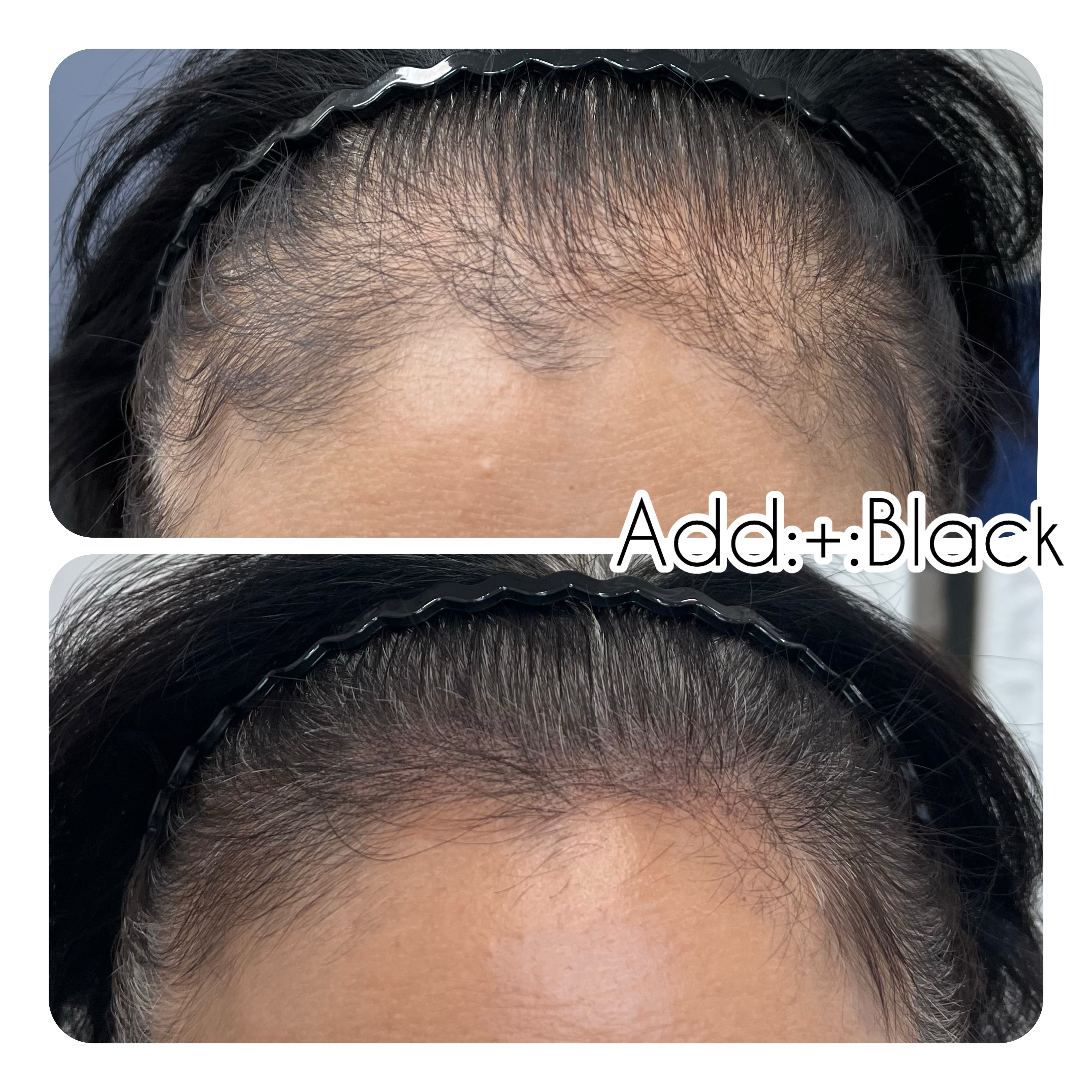 애드블랙 대표 이미지