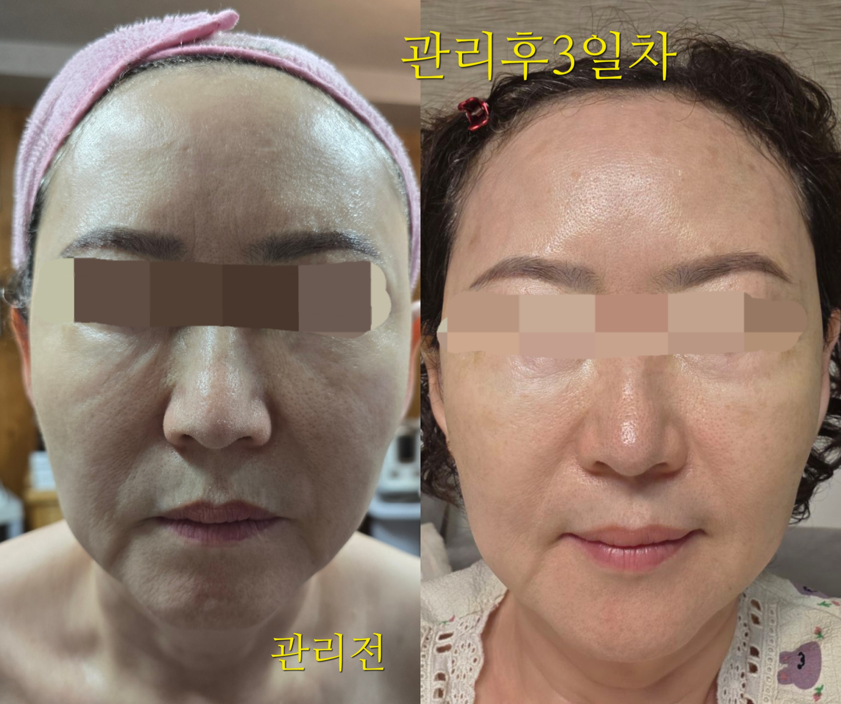 뷰티스킨케어 개봉동본점 대표 이미지