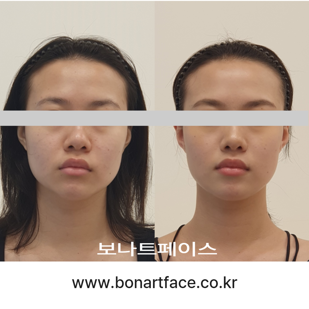 보나트페이스 대표 이미지