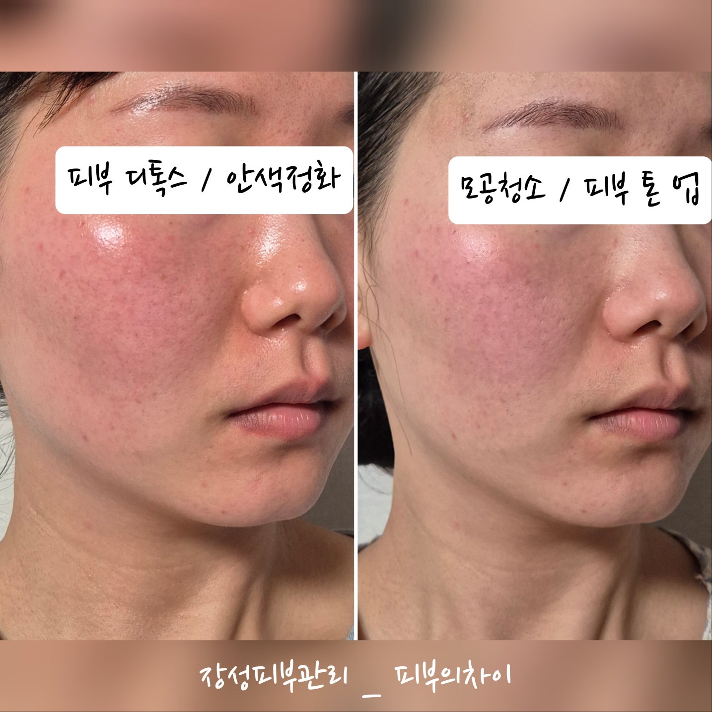 피부의차이 photo 4