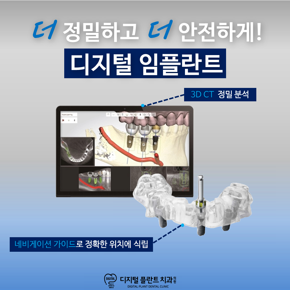 디지털플란트치과의원 대표 이미지