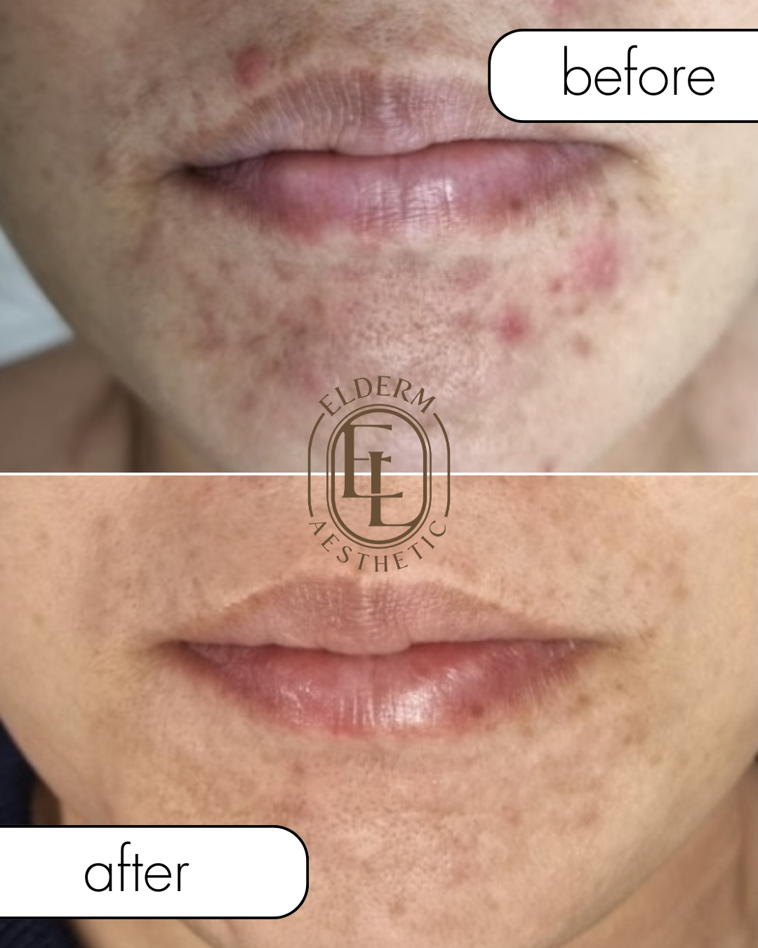 엘덤에스테틱 대표 이미지