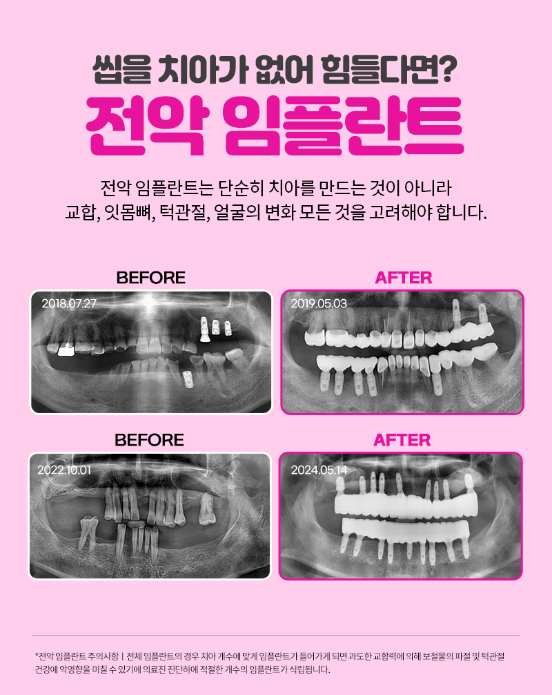 서울브라운치과의원 대표 이미지