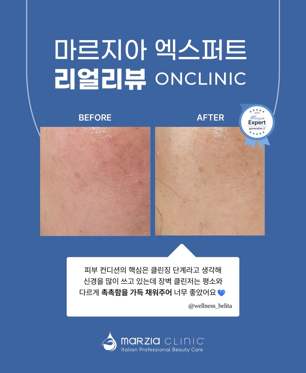 힐스킨7에스테틱