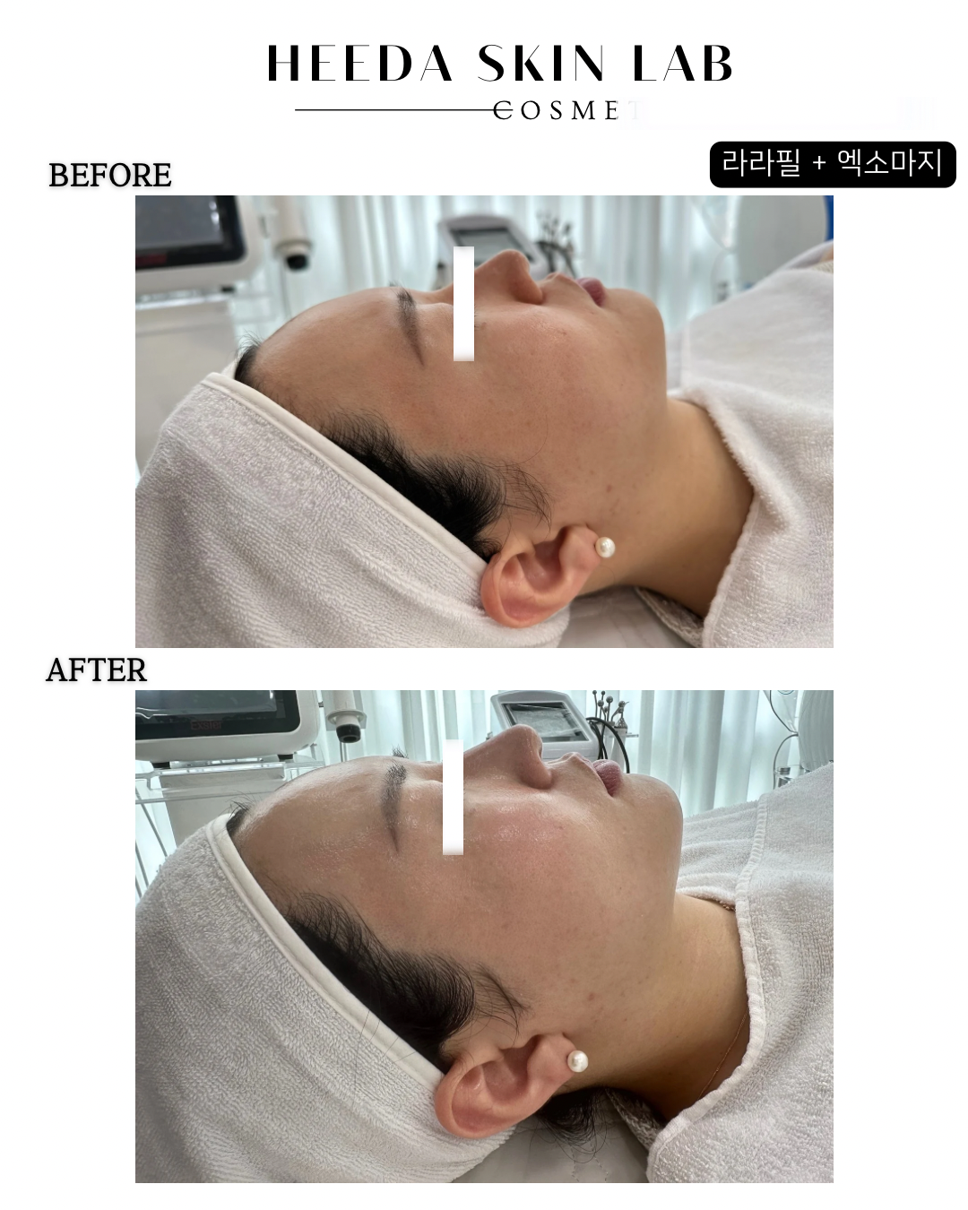 희다스킨랩 대표 이미지