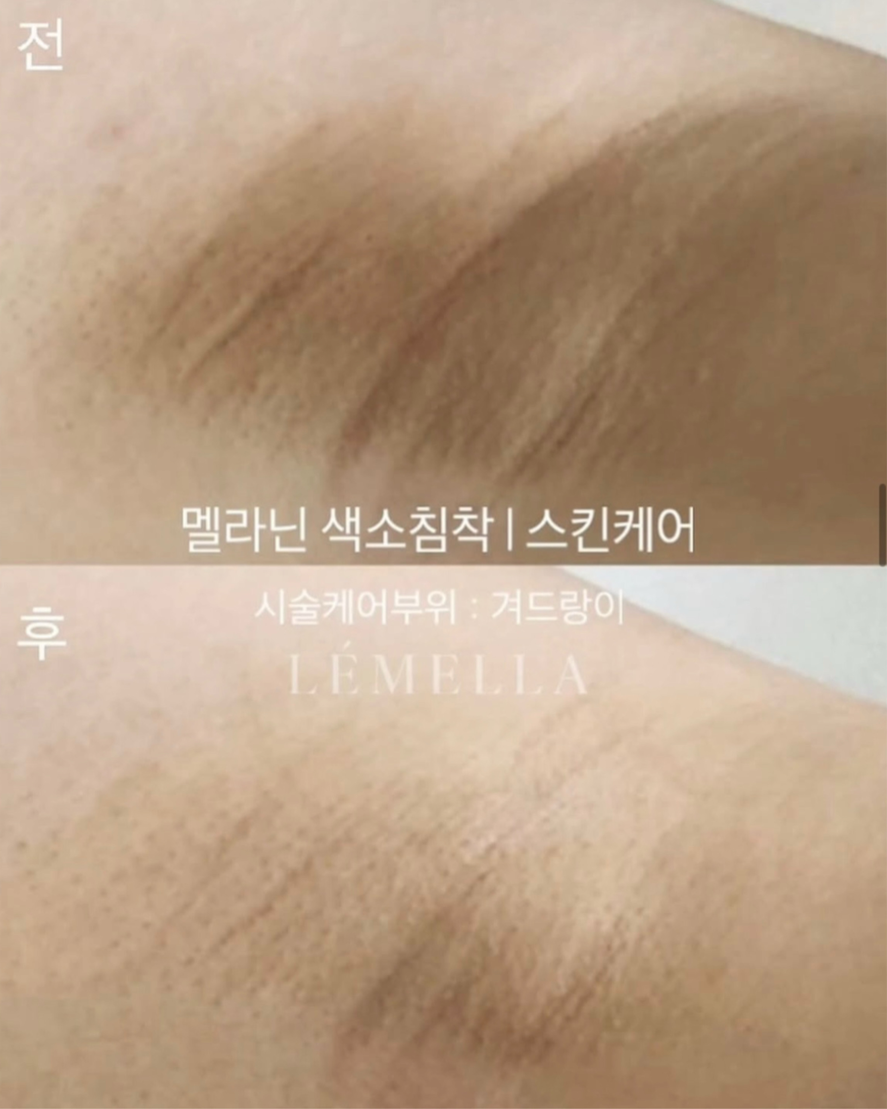 로제토뷰티 대표 이미지