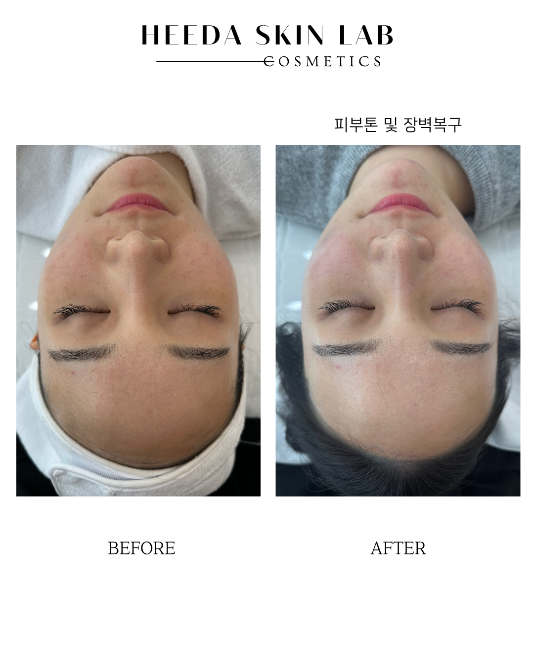희다스킨랩 대표 이미지