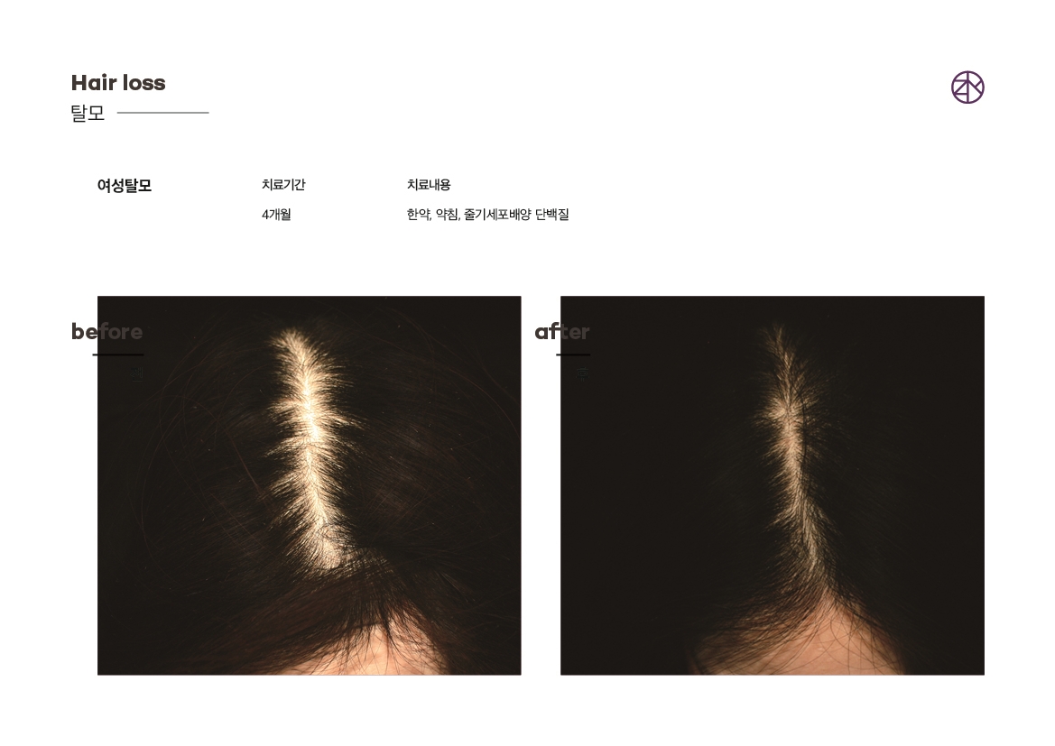 존스킨한의원 대표 이미지