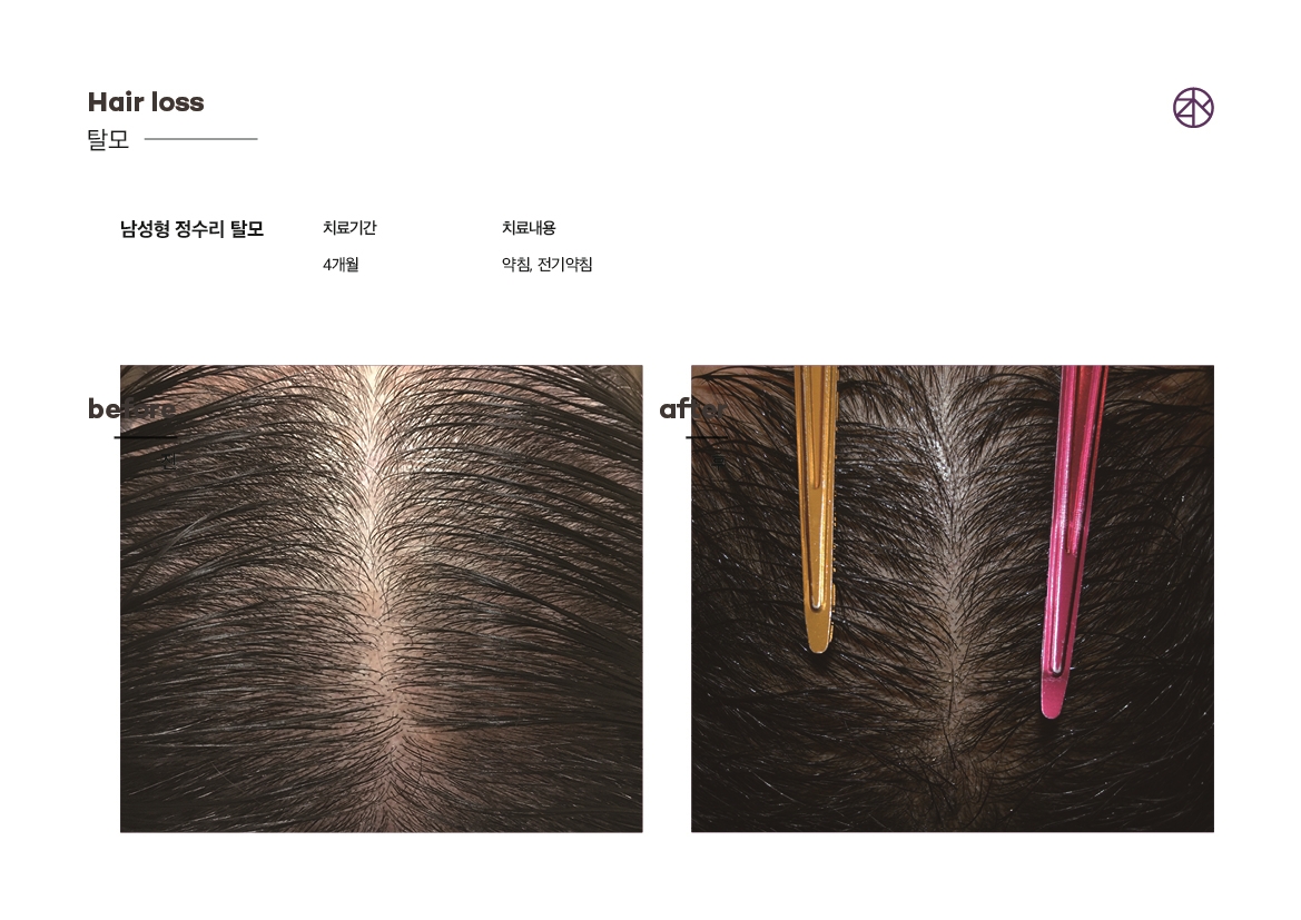 존스킨한의원 잠실점 대표 이미지