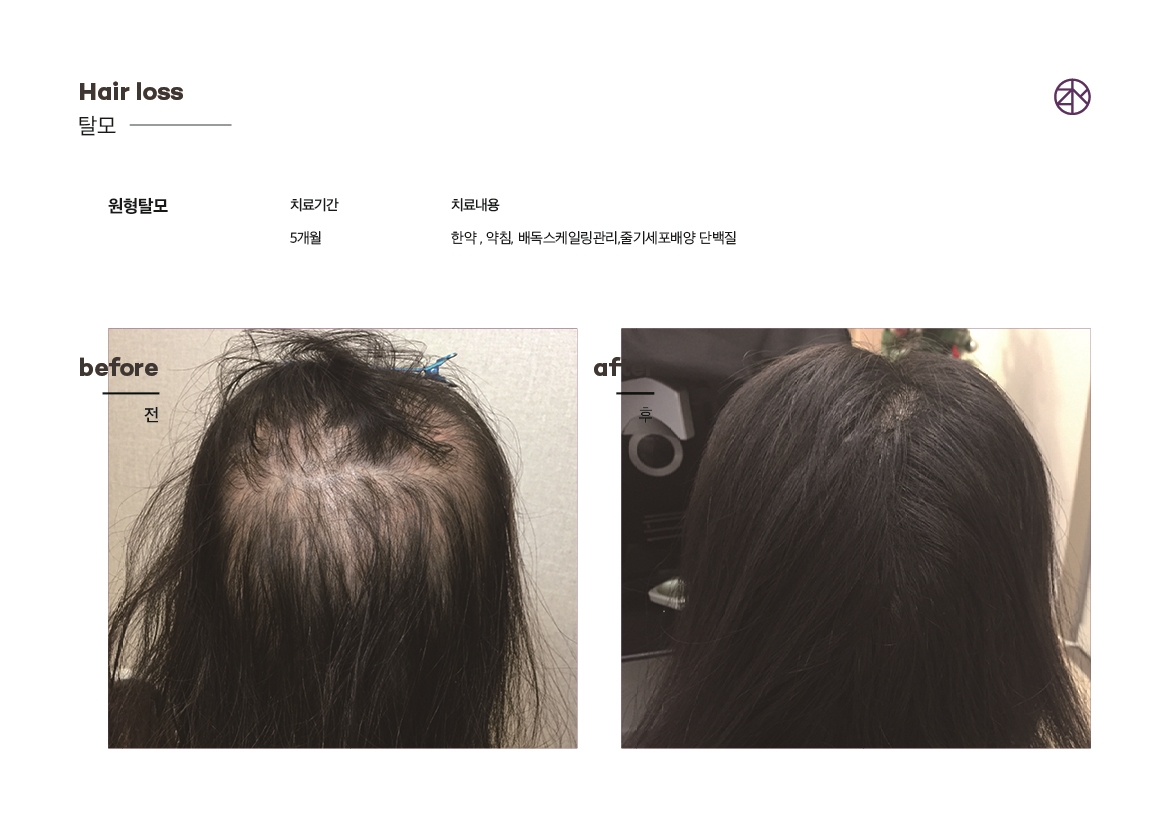 존스킨한의원 잠실점 대표 이미지