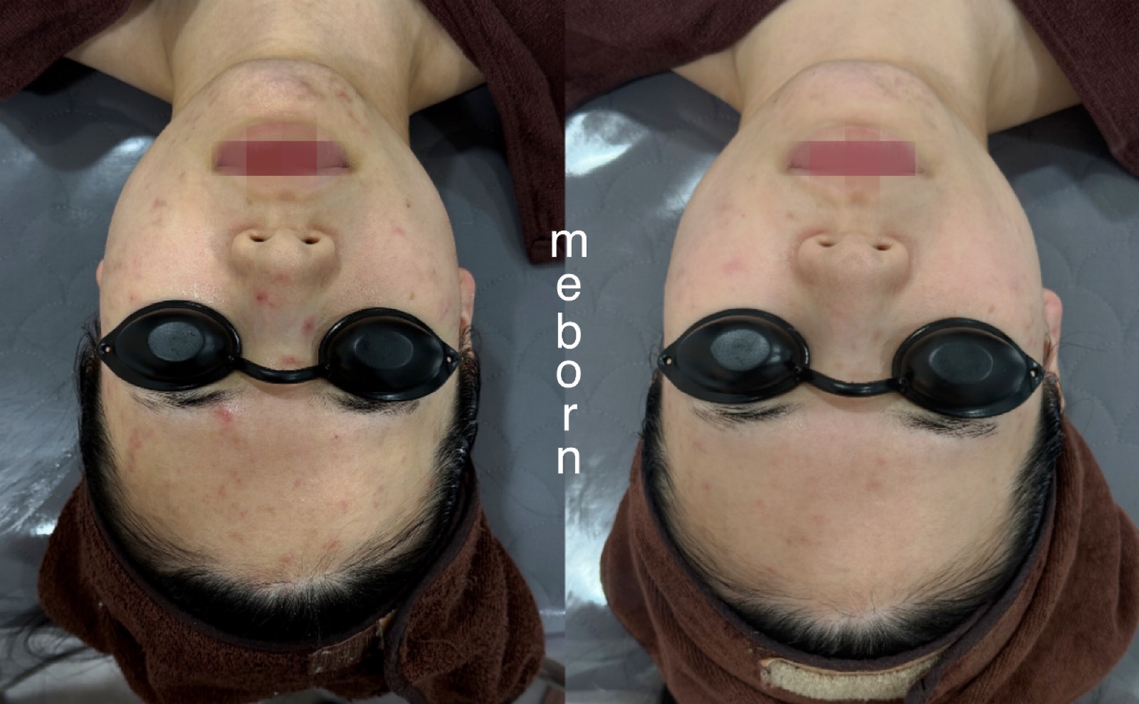 미본에스테틱 대표 이미지