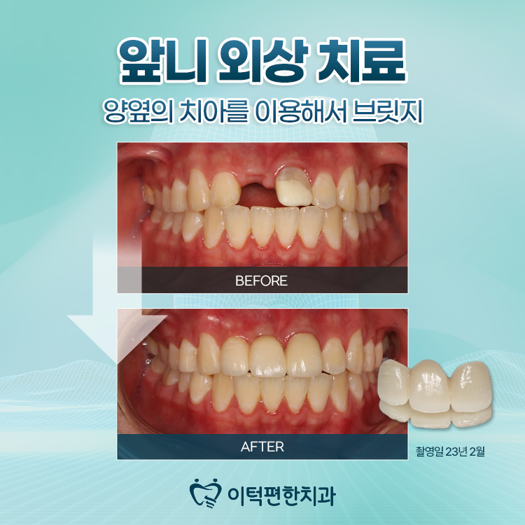 이턱편한치과의원 대표 이미지