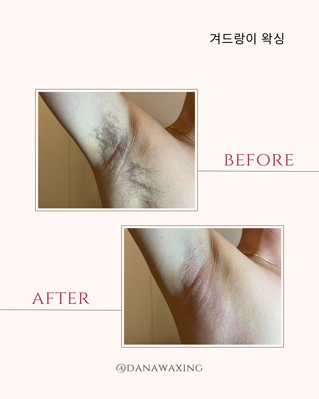 다나왁싱 대표 이미지