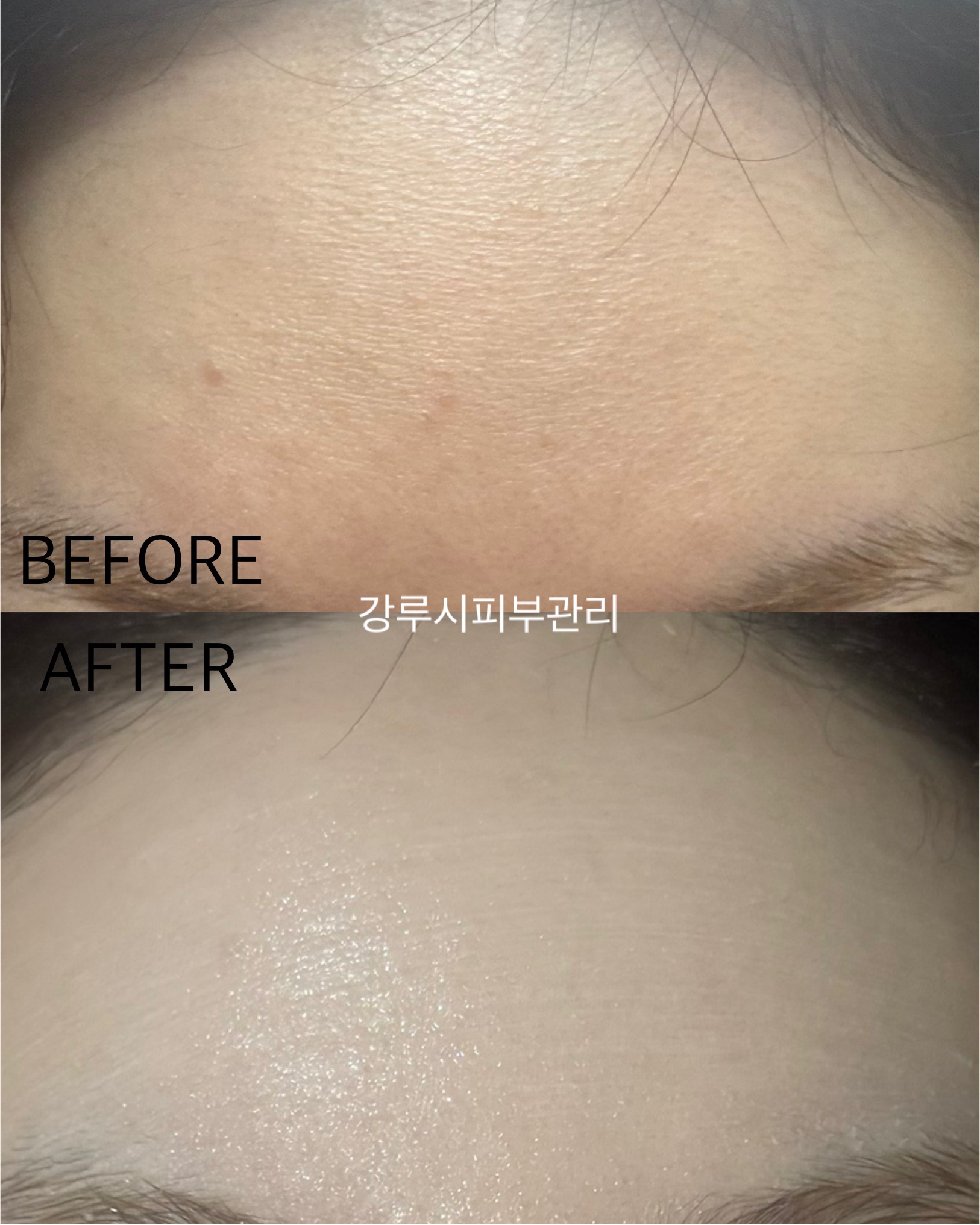 강루시피부관리 대표 이미지