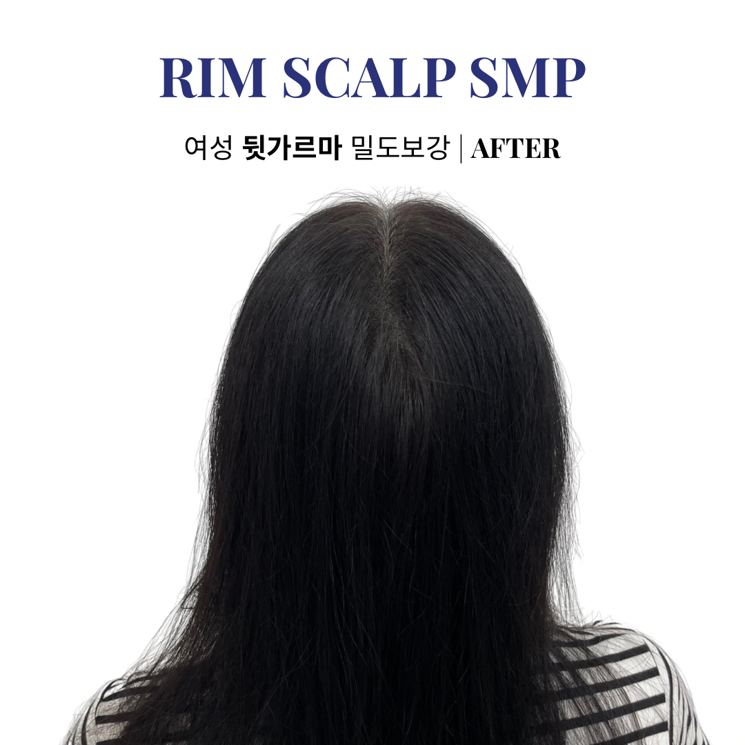 림스칼프 대구본점 대표 이미지