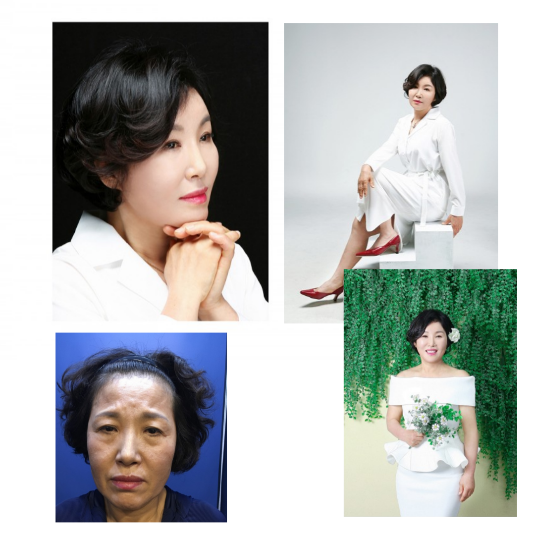 강남더뷰티성형외과 이미지