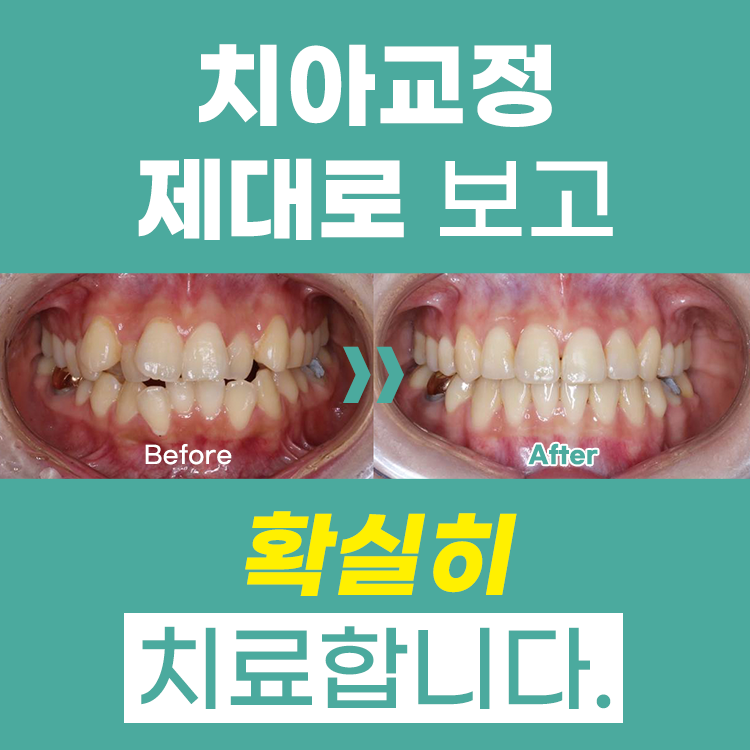 웰스치과의원 개포도곡점 대표 이미지