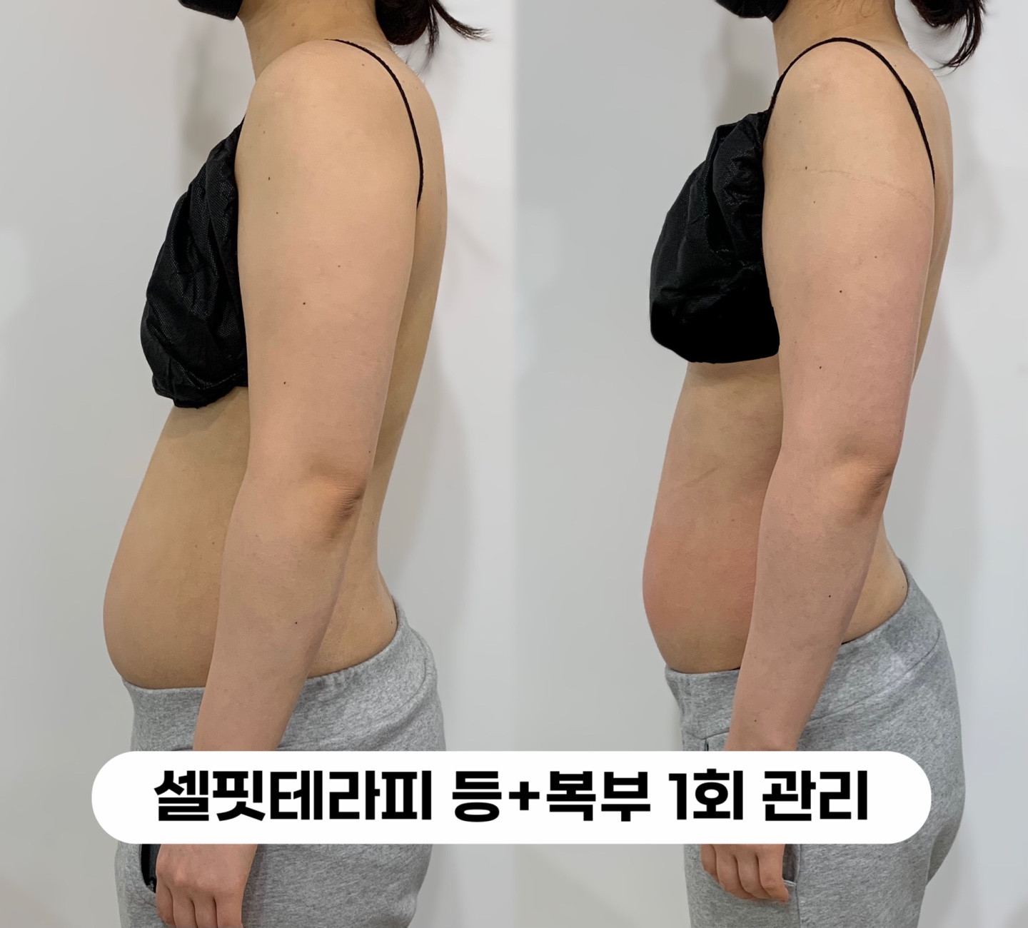 글로우즈 대표 이미지
