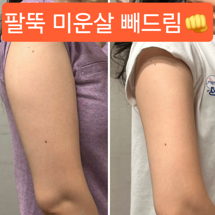 헤리티지스파 미아점