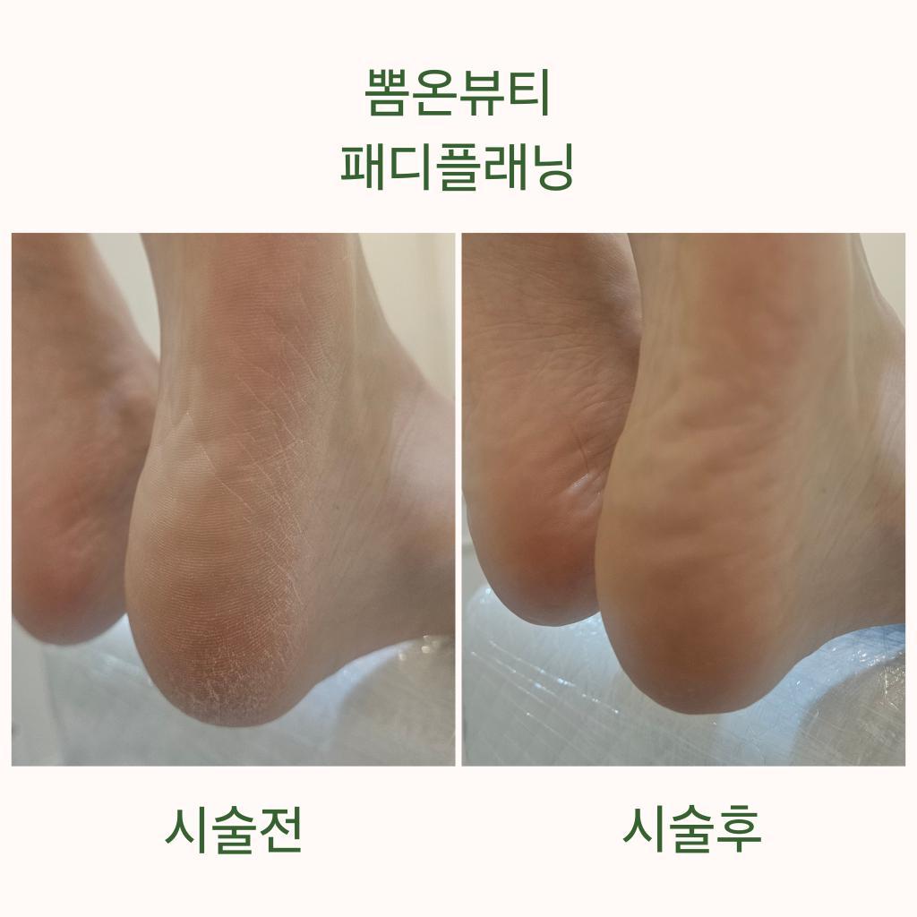 뽐온뷰티 대구본점 대표 이미지