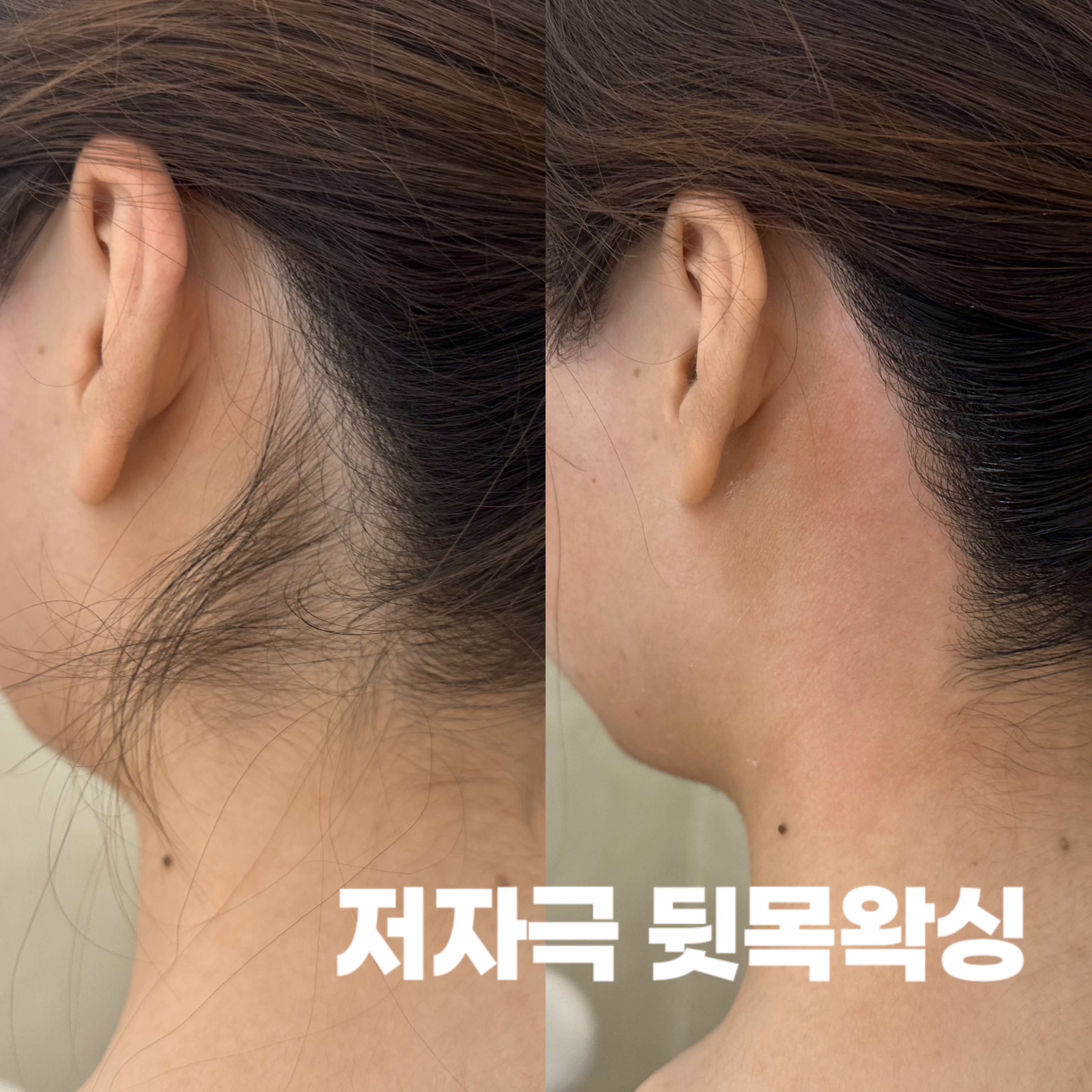 팔공뷰티 왁싱 달서죽전점 대표 이미지