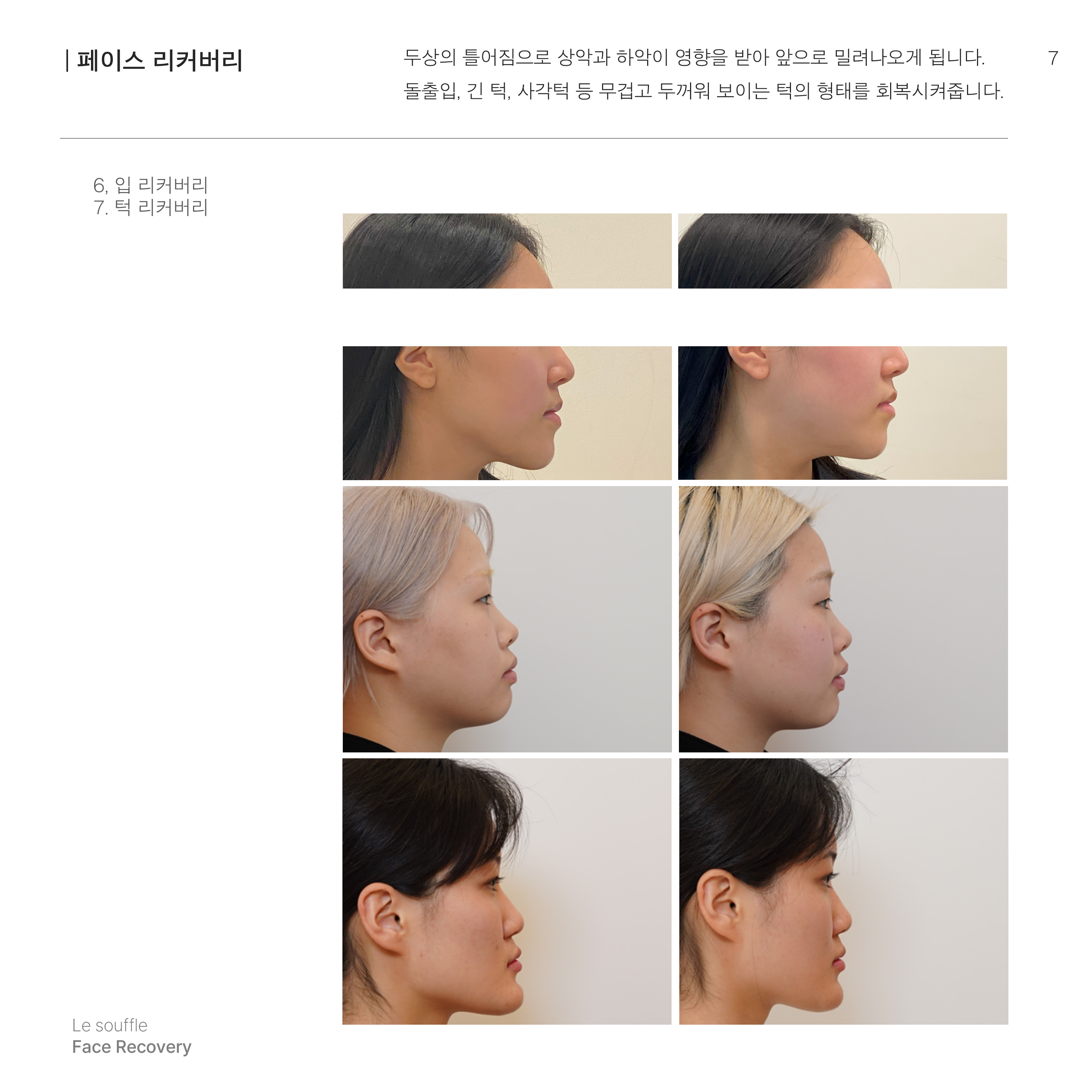 르수플 대표 이미지