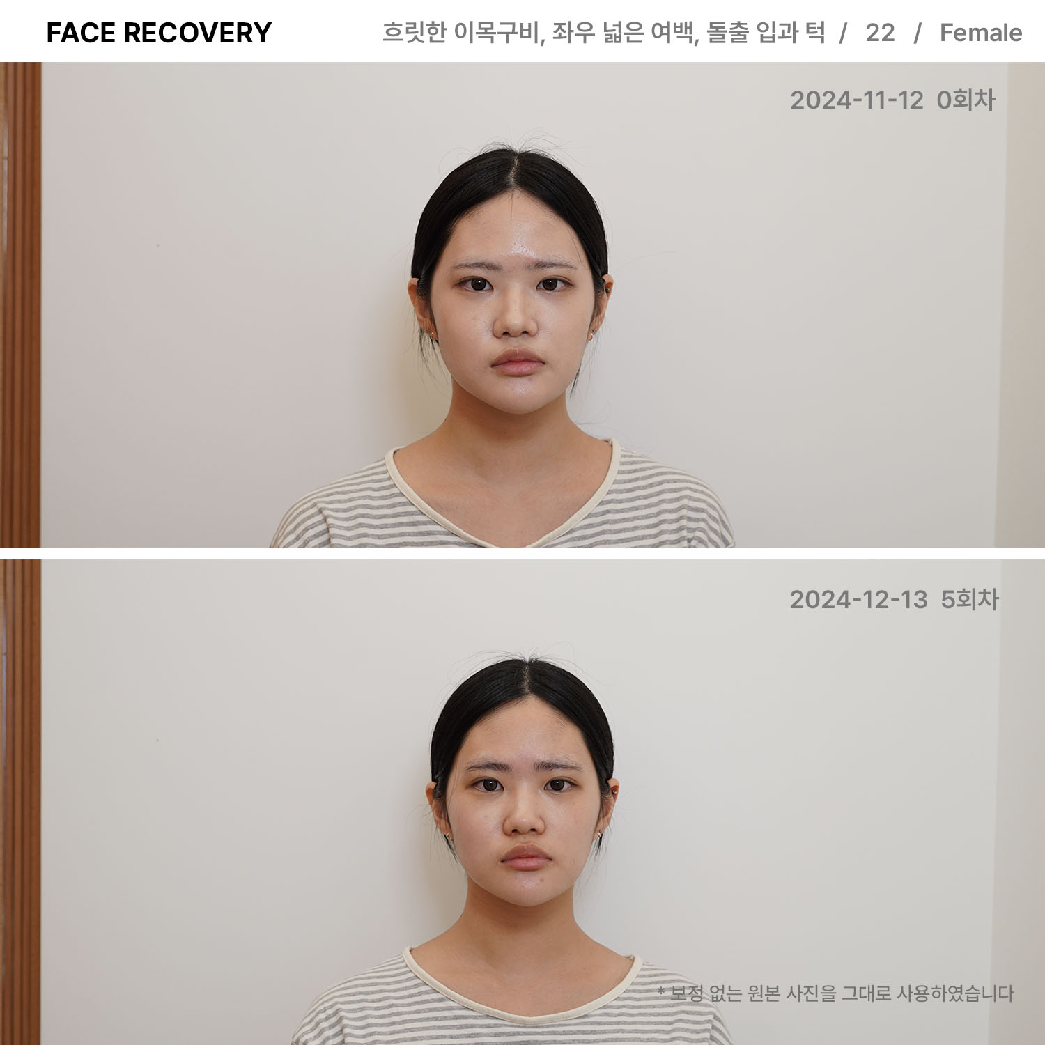 르수플 대표 이미지