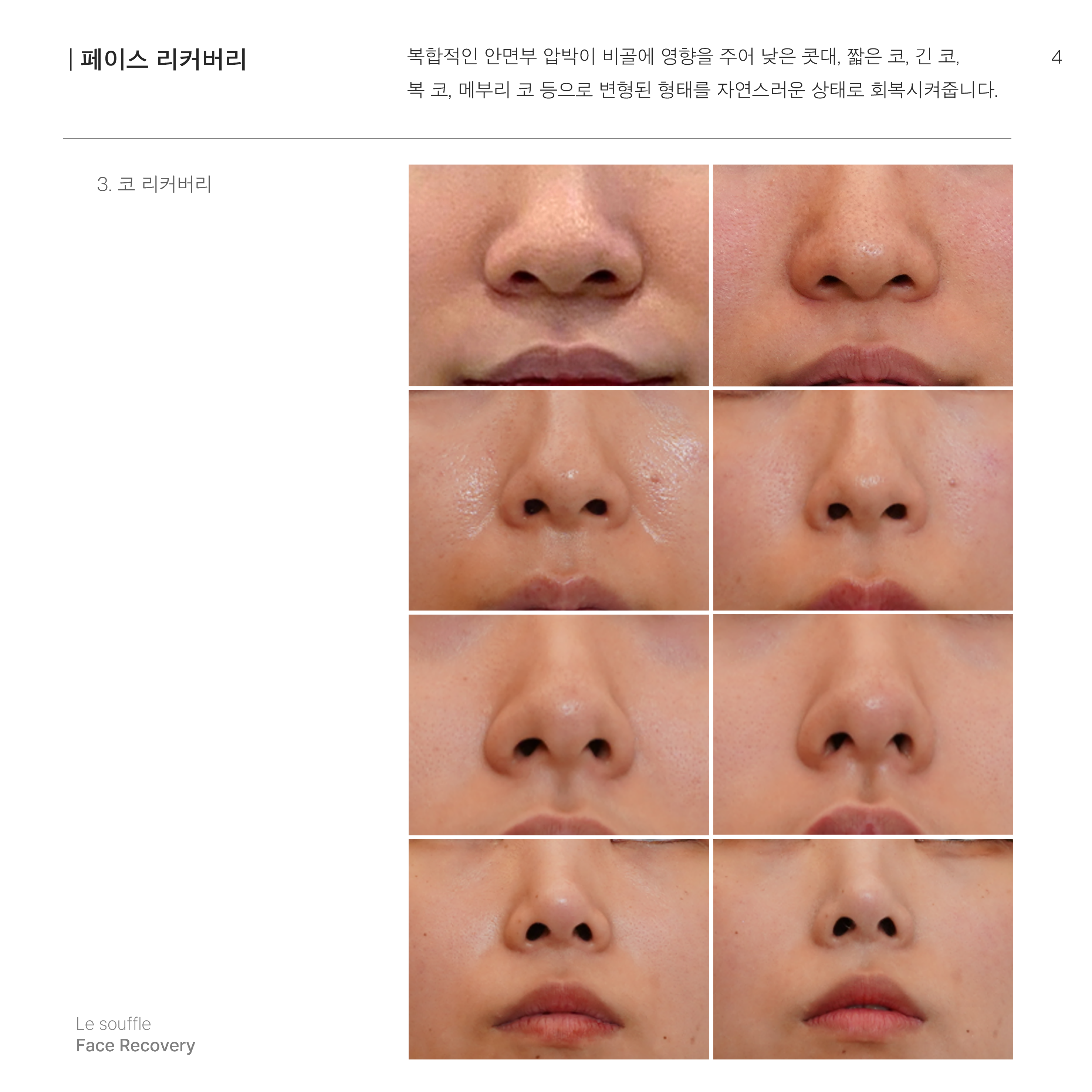 르수플 대표 이미지