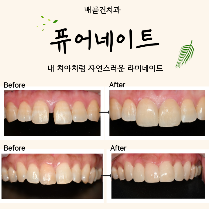 배곧건치과의원 대표 이미지