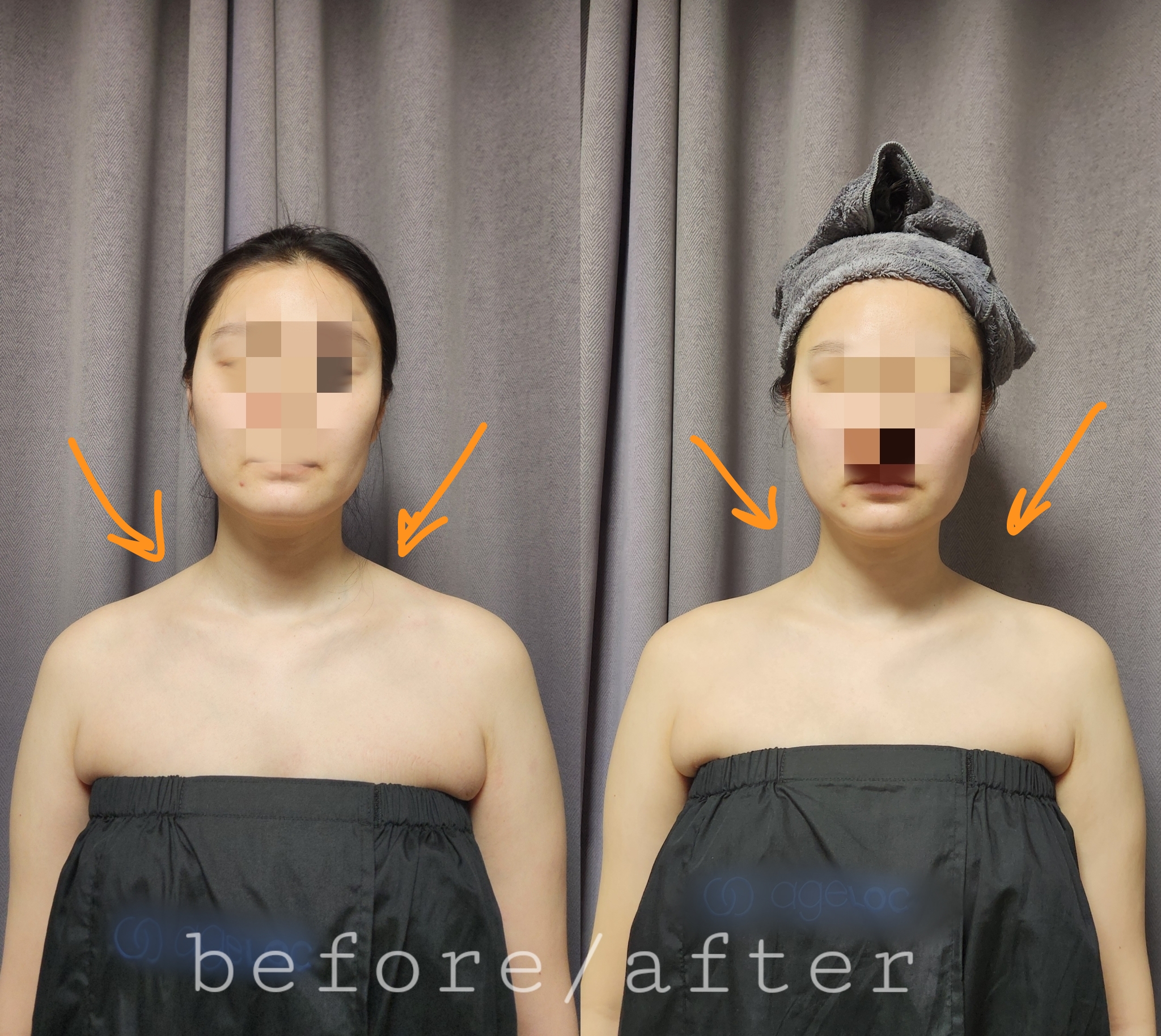 슬리밍뷰티 용산점 대표 이미지