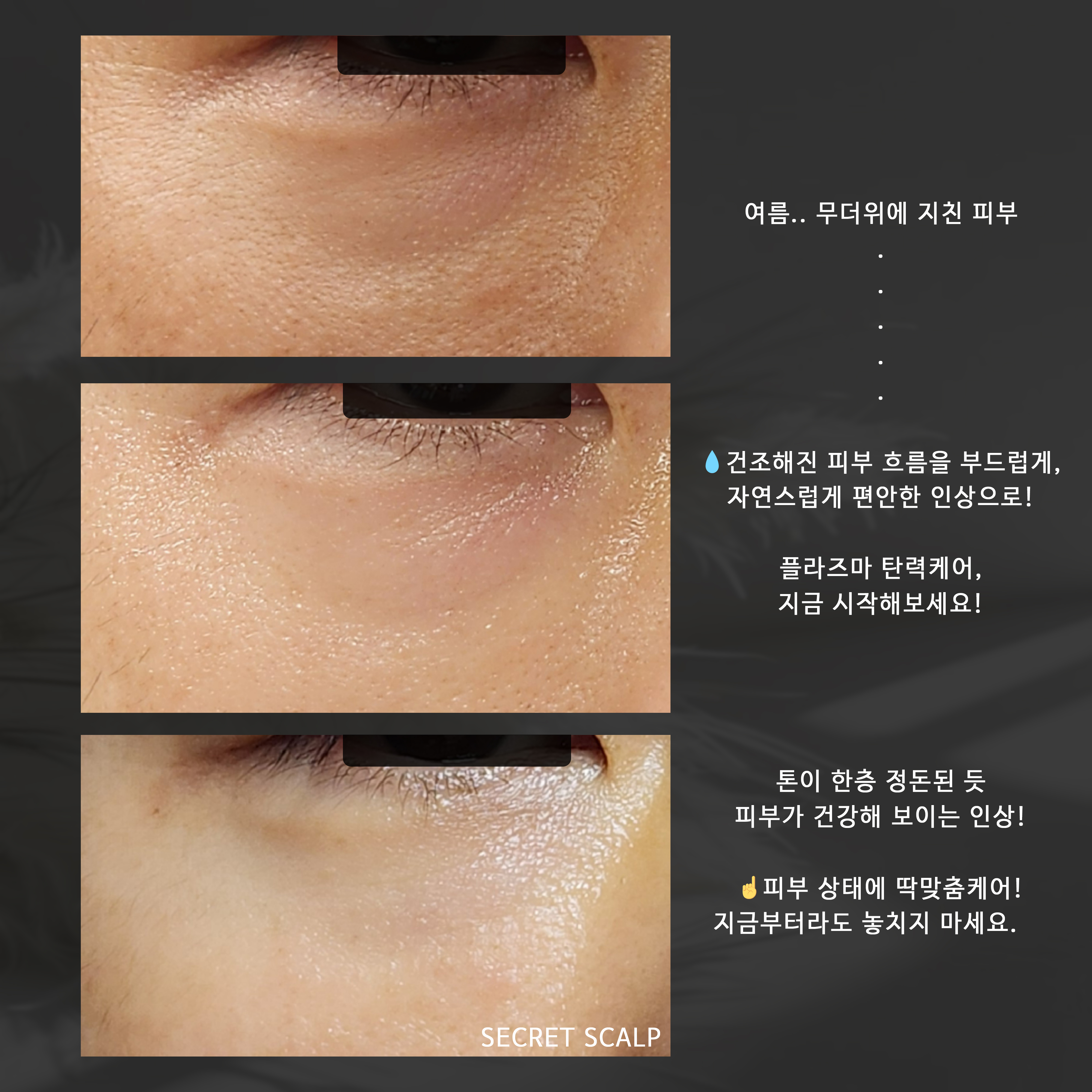 시크릿스칼프 대표 이미지