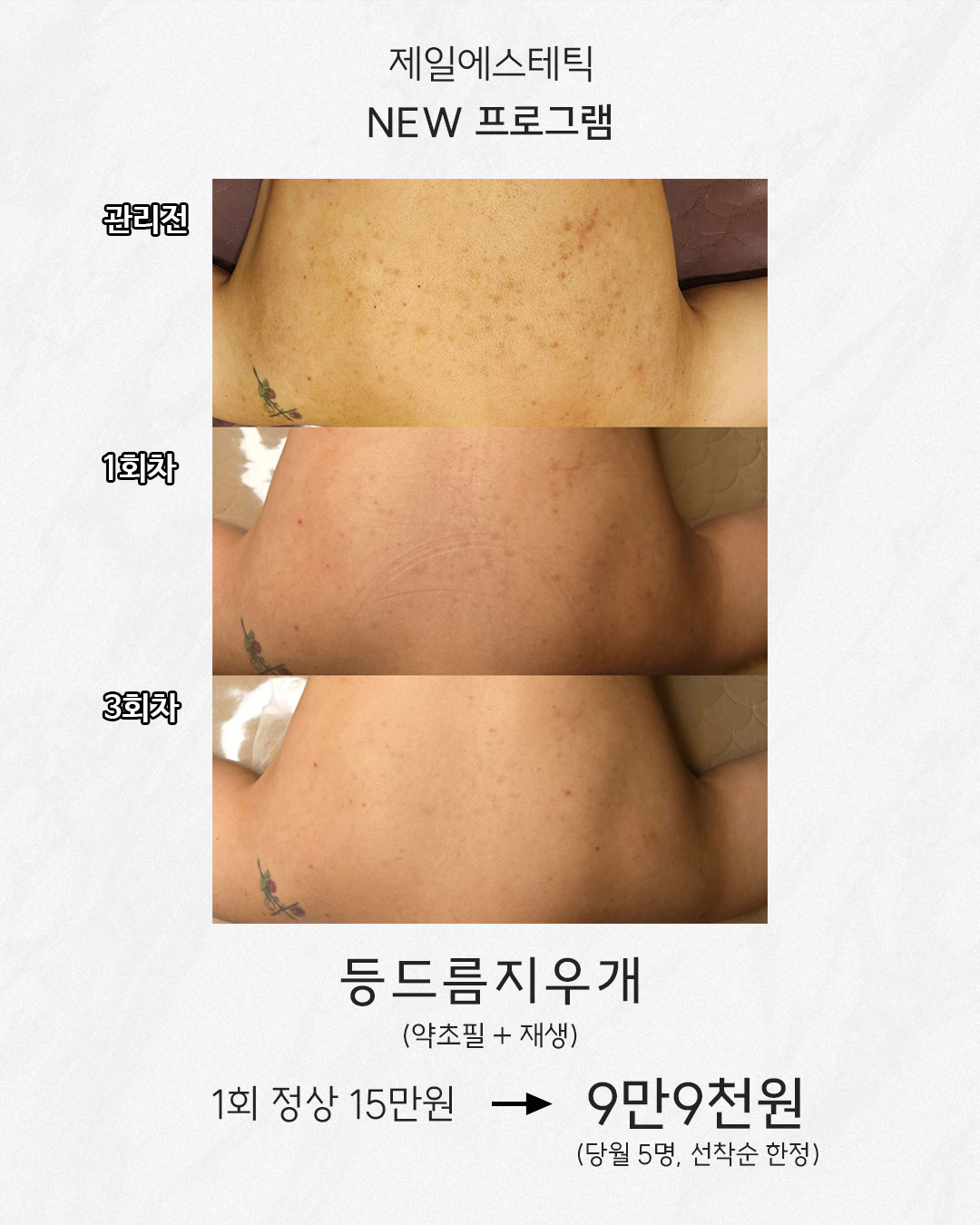 제일에스테틱 화곡점 대표 이미지