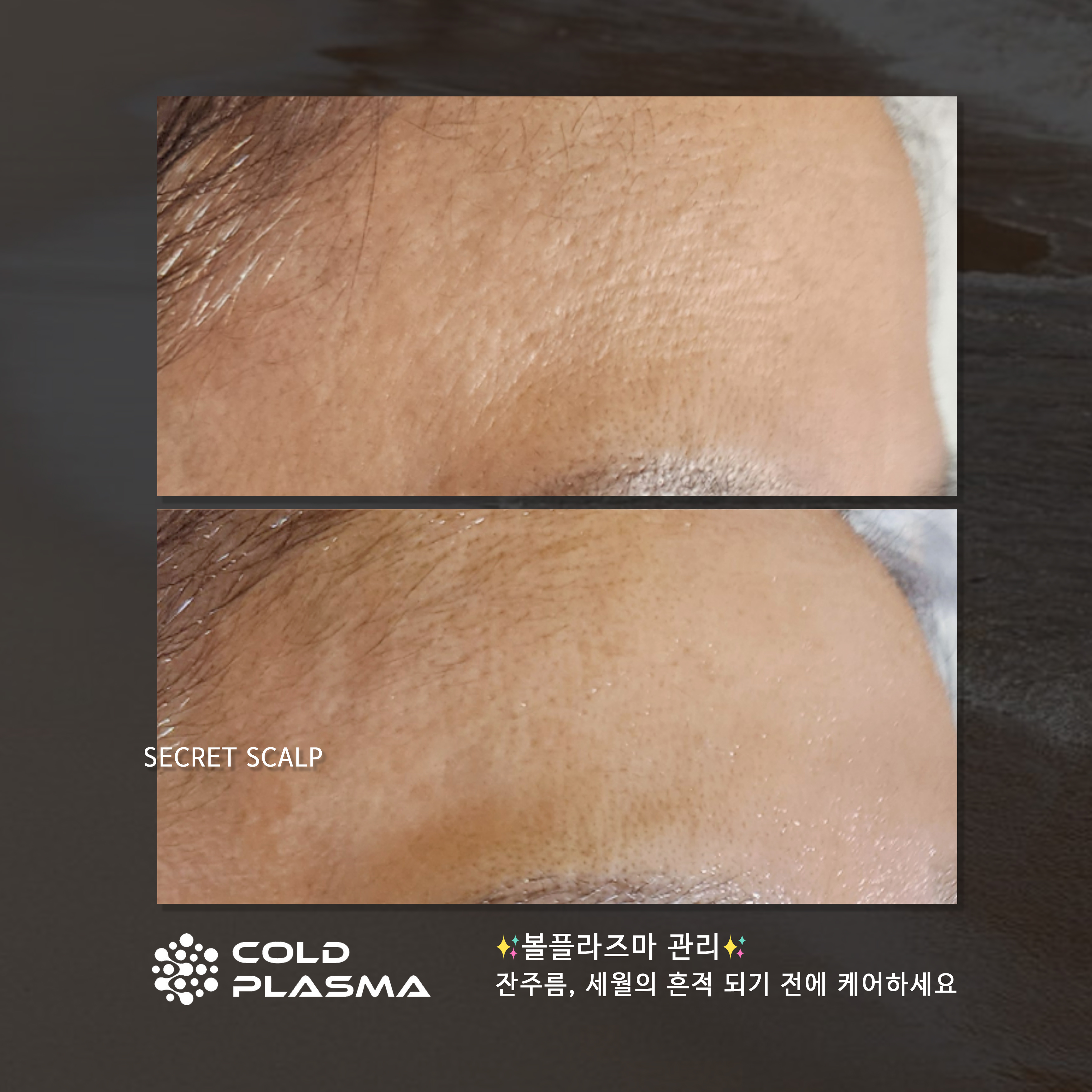 시크릿스칼프 대표 이미지