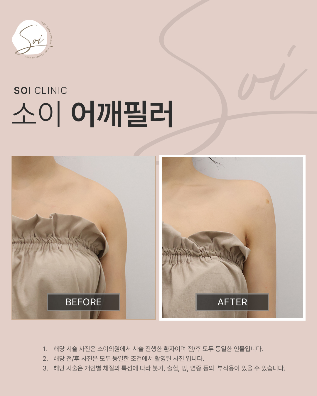 소이의원 대표 이미지