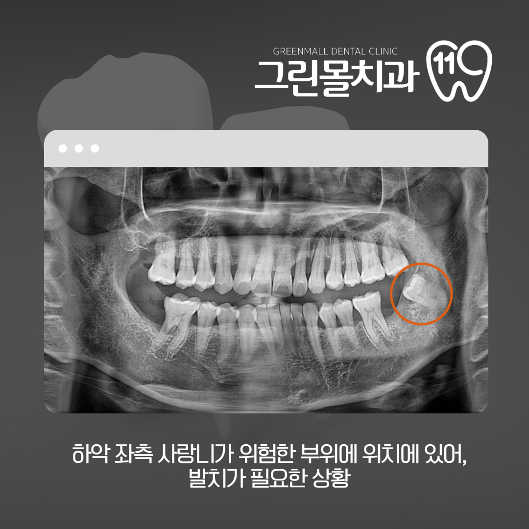 그린몰치과의원 대표 이미지