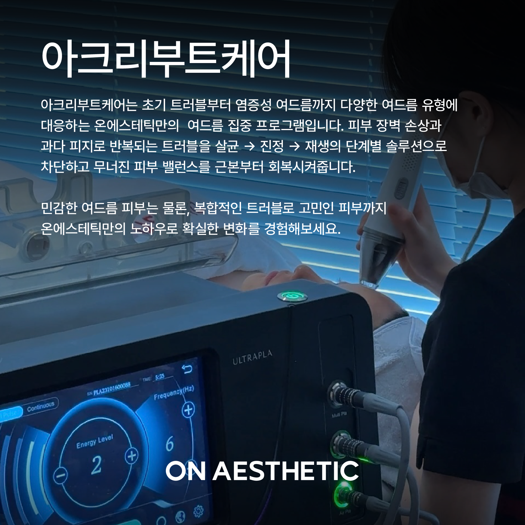온에스테틱