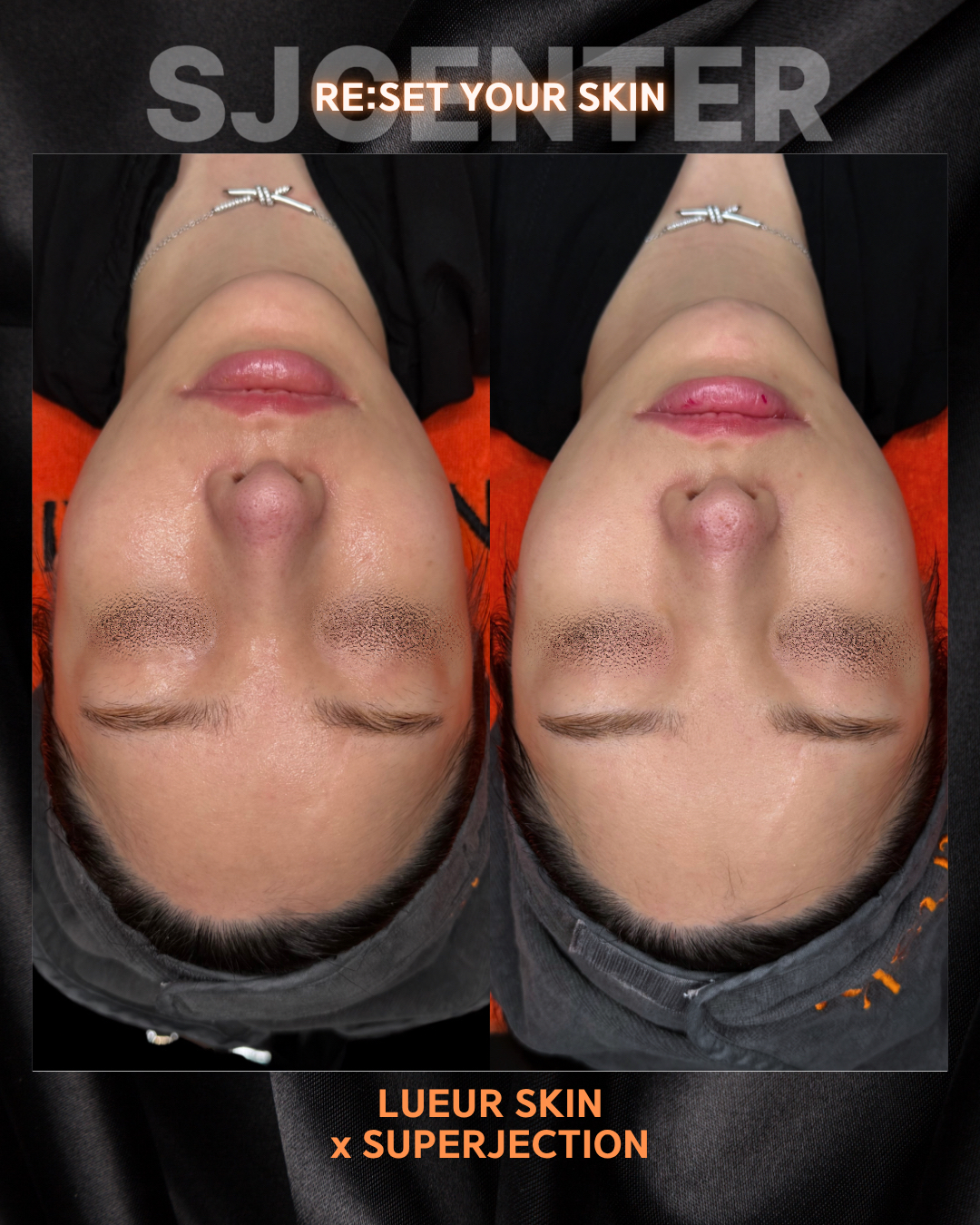 뤼에르스킨 왕십리본점 대표 이미지