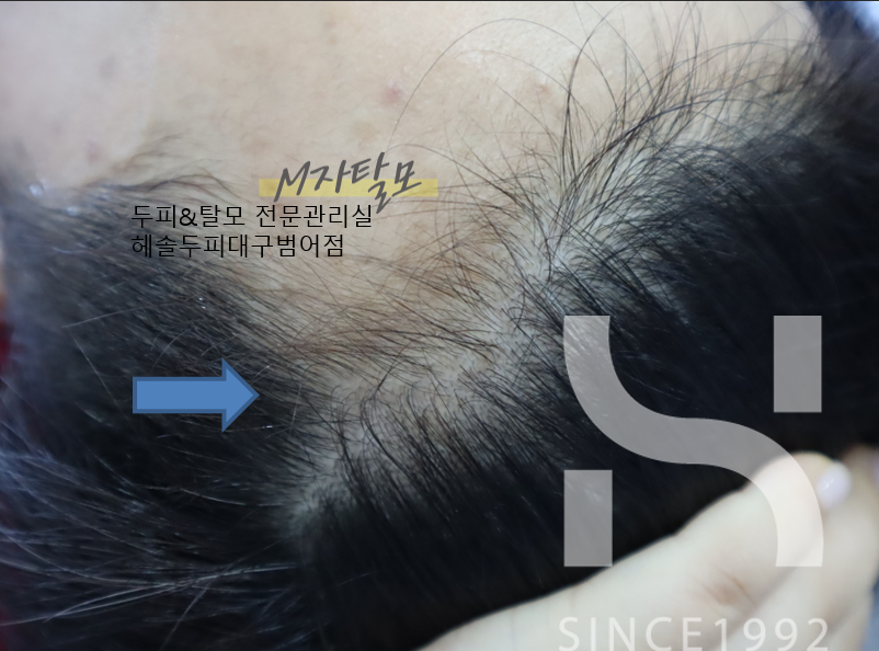 헤솔두피클리닉스 대구범어점 대표 이미지