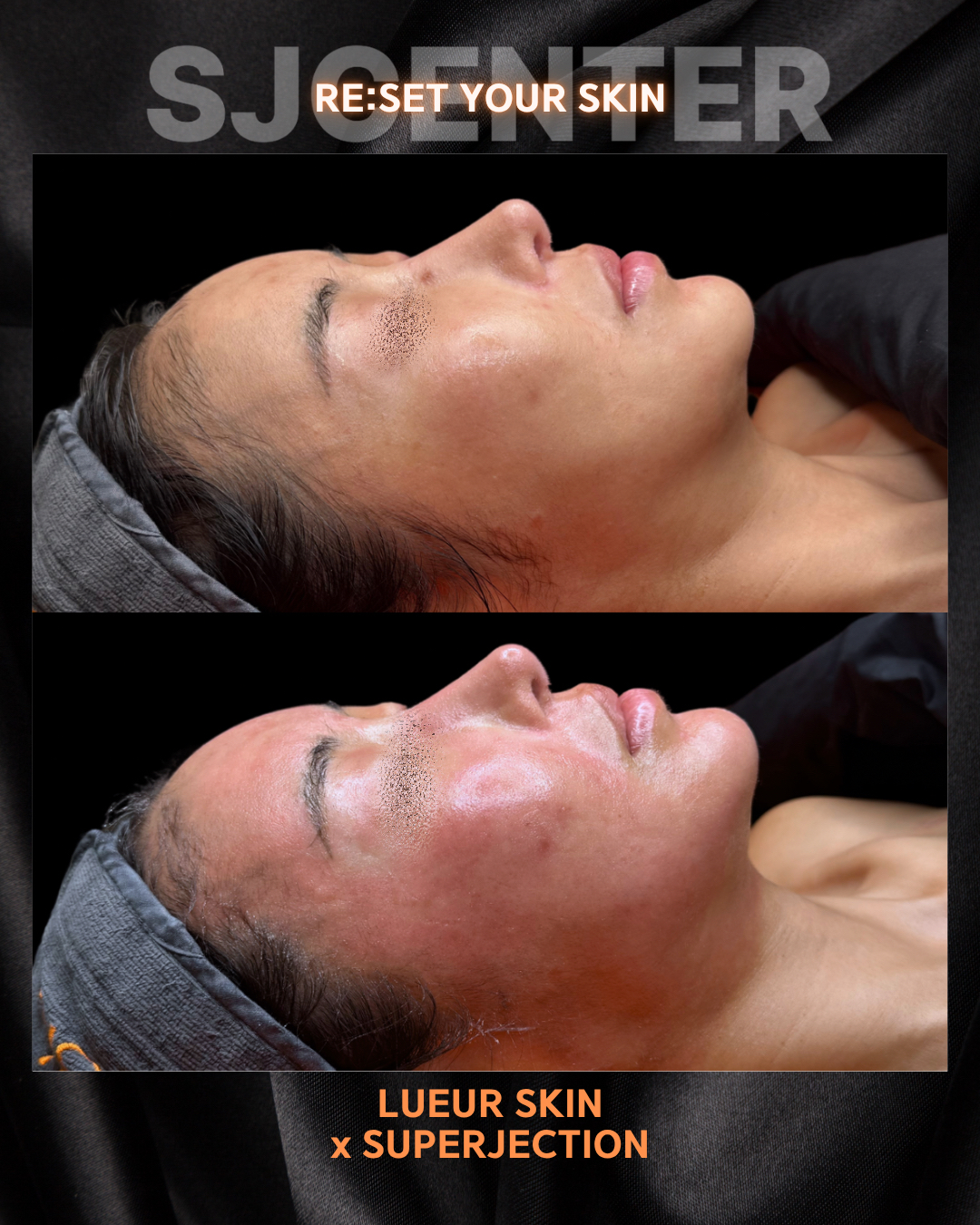 뤼에르스킨 왕십리본점 대표 이미지