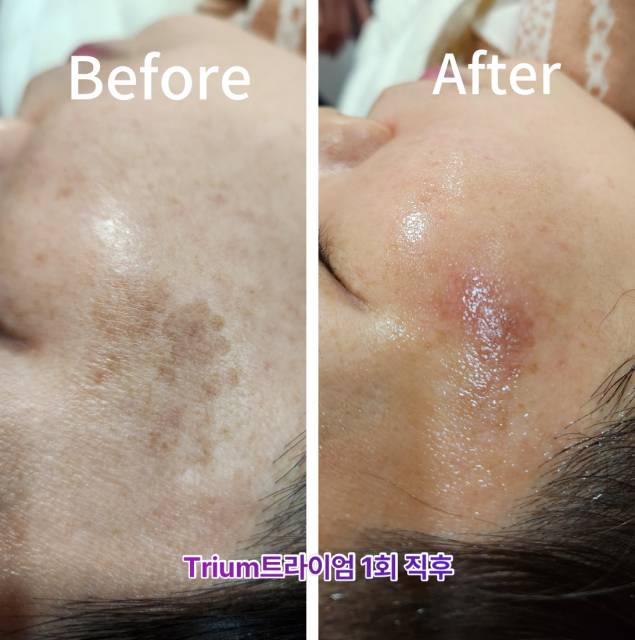에스티뷰티 photo 10