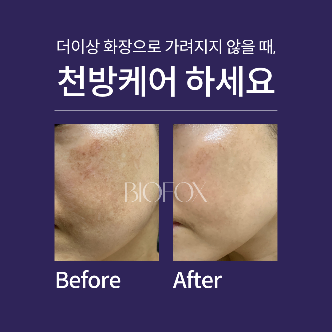 린다아이래쉬 대표 이미지