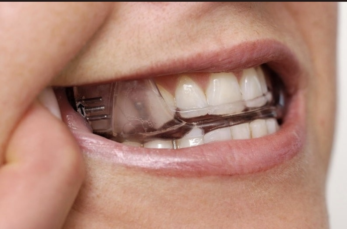 광화문연세치과의원 대표 이미지