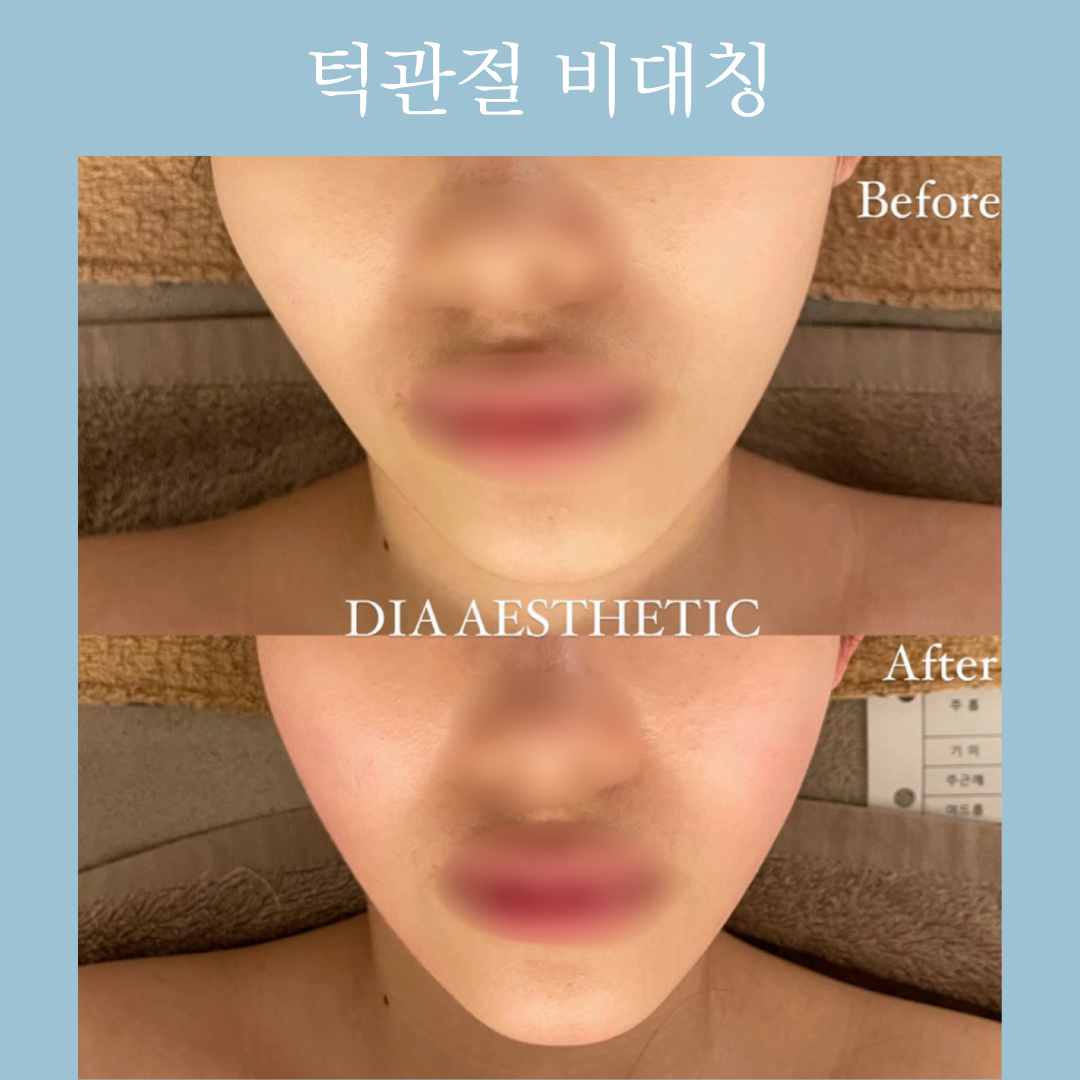 다이아에스테틱 대표 이미지