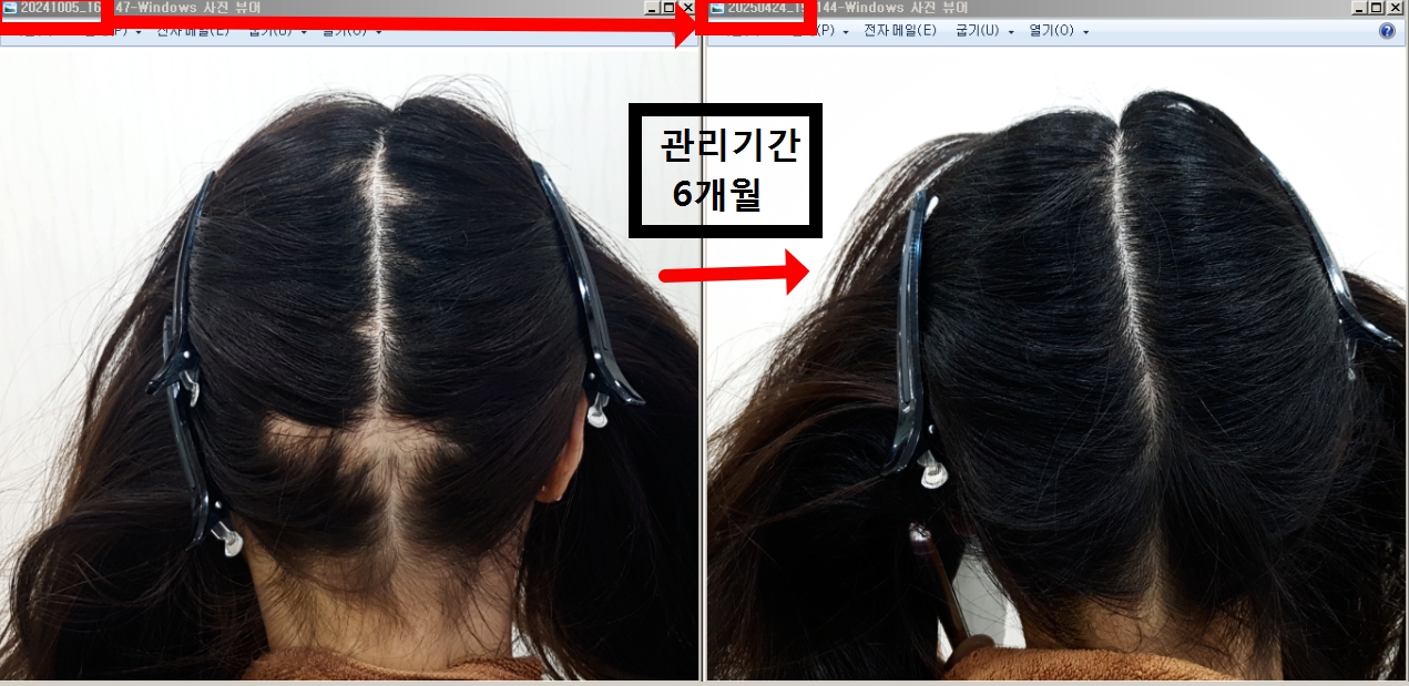 탈모 아미치 0.3 공덕점 대표 이미지